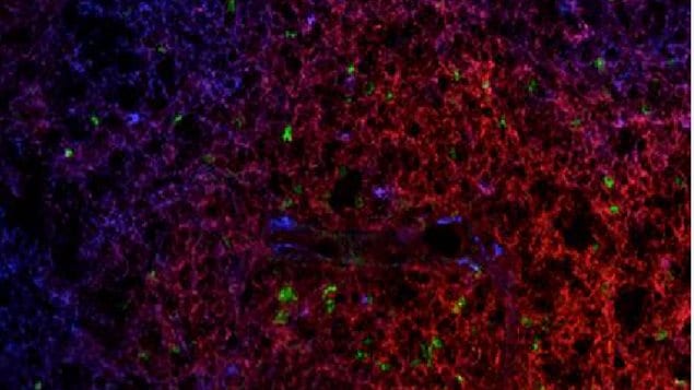 The image shows a lymph node in which we see normal T cells (in red) and Treg cells regulated by the FOXP3 gene (in green). Lymph nodes are small glands that are part of the lymph system which is important for body’s defense system against diseases. Technique used: Confocal microscopy 