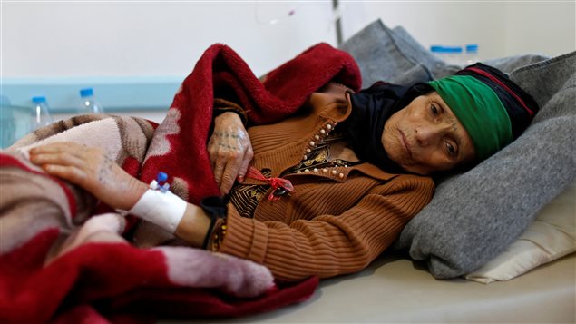 A woman with suspected cholera infection lies on a bed at a cholera treatment center in Sanaa, Yemen, May 15, 2017.