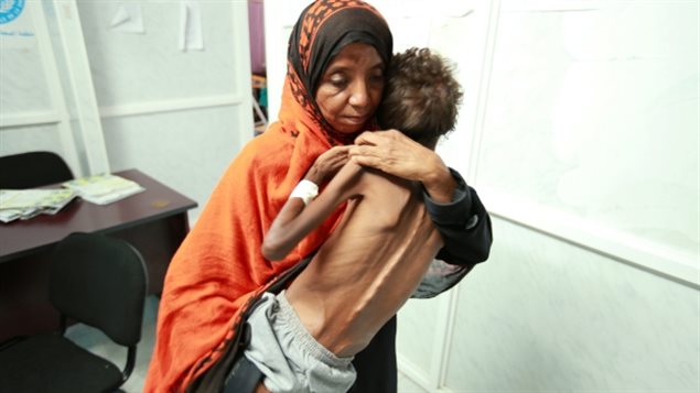 امرأة يمنية تحمل طفلها البالغ من العمر ثماني سنوات والبادية عليه آثار سوء التغذية في 13 حزيران (يونيو) الفائت في مستشفى في مدينة الحديدة الواقعة على ساحل البحر الأحمر 