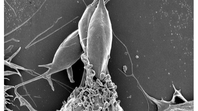 In this electron microscope image, a Leishmania parasite (above) is shown entering a type of immune cell known as a macrophage (below). 