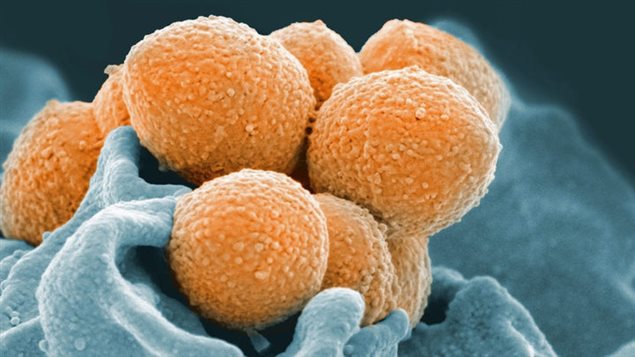 Group A Streptococcus may not look like much under an electron microscope but it can be invasive and cause death.