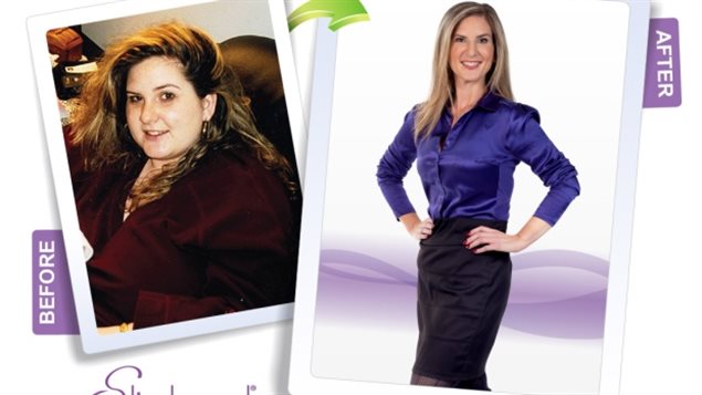 A Slimband ad shows an employee’s photo from before and after she underwent gastric band surgery.