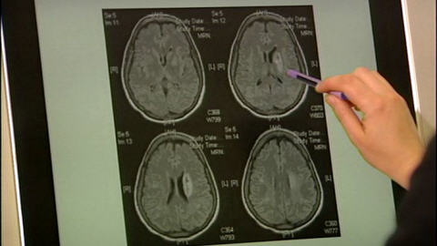 Cerveau