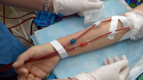 Dialyse-sang