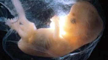 foetus-ventre