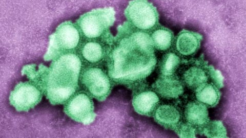 Virus de la grippe A (H1N1)
