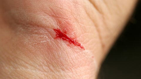 Une petite cicatrice