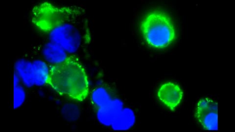 Cellules souches placentaires mortes en raison du BPA