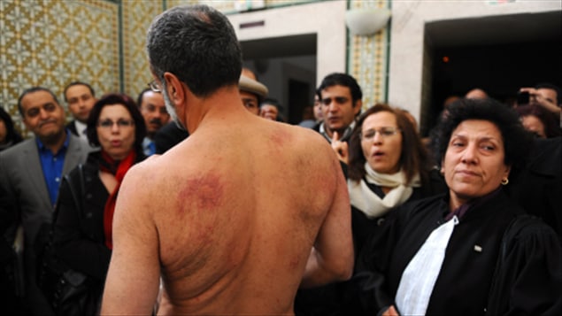 L'avocat Abderrahman Ayedi montre des marques de tortures sur son torse à des activistes des droits humains, le 29 décembre, à Tunis.