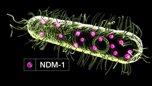 Premi Re Infection Une Superbact Rie Produisant La NDM 1 Au Canada   110212super Bacterie Ndm 1 Sn635 