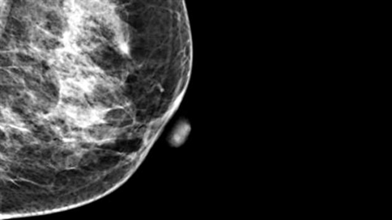 Buy premarin in canada