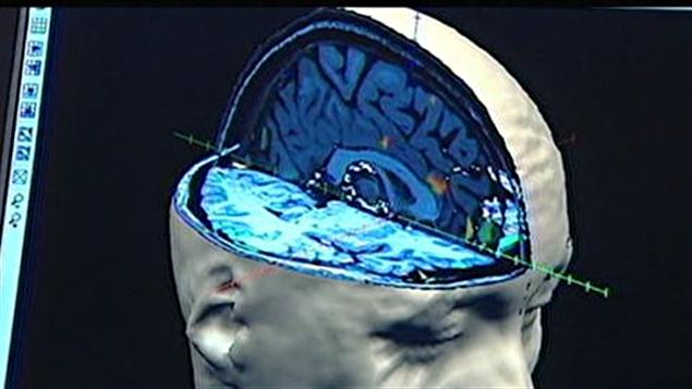Imagerie médicale