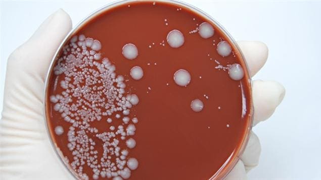 Scientist holding an agar plate which is growing E.coli