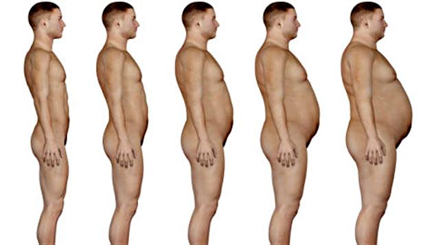 Évolution de l'obésité chez un homme