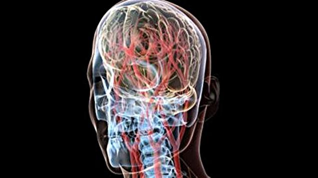 Cerveau