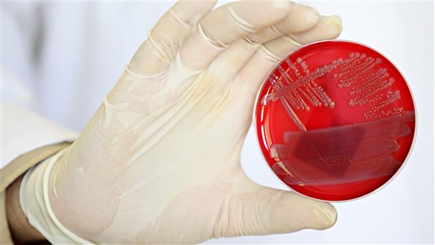 E Coli EHEC