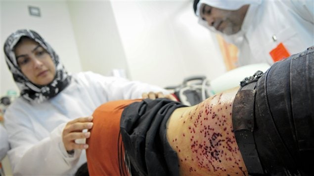 Un homme blessé après l'imposition de la loi martiale au Bahreïn se fait soigner à l'hôpital Salmaniya le 15 mars 2011.