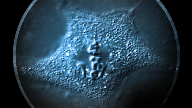Cellule cancéreuse