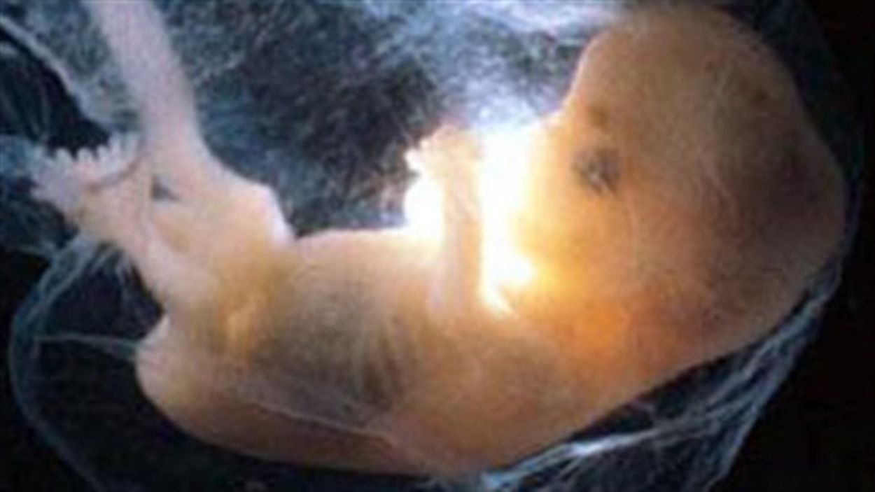 Morts foetales : le placenta premier responsable | Radio-Canada