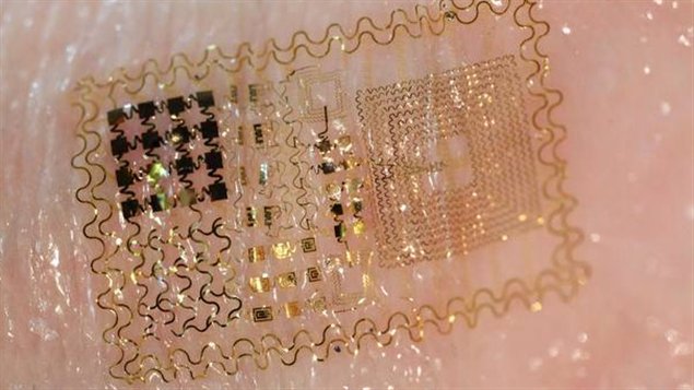 Le système électronique épidermique