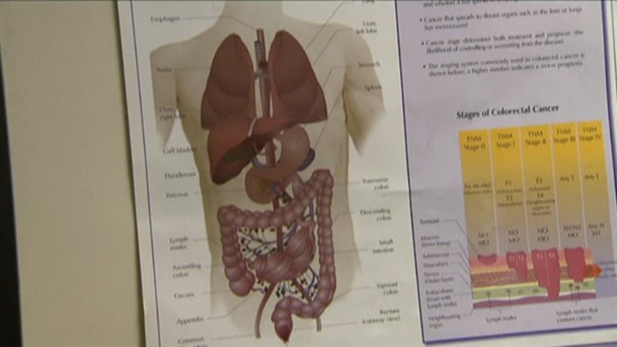 Cancer colorectal tests pour les 50 ans et plus Radio