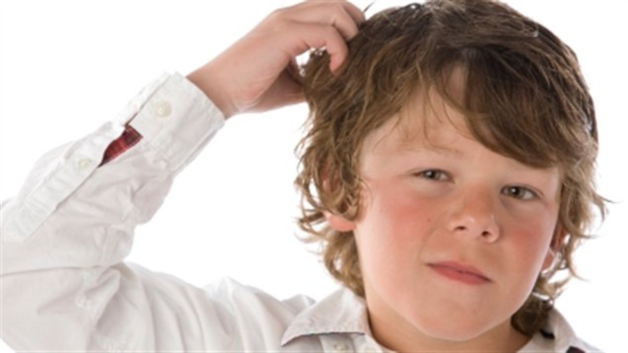 10 Conseils Pour Se Debarrasser De Poux 10 Conseils Pour Radio Canada Ca