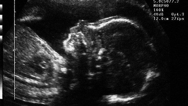 Un foetus, environ cinq mois après la conception