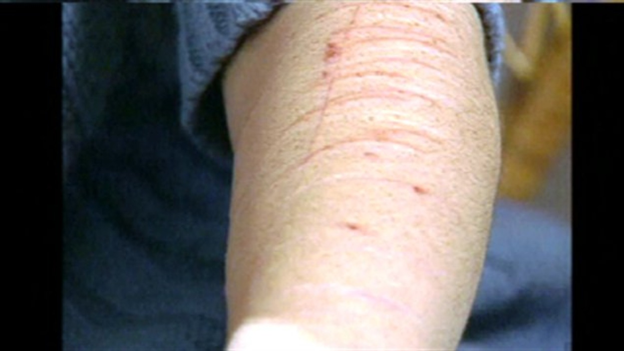 Comment Cacher Des Marques De Mutilation Augmentation des cas d'automutilation dans la prison pour femmes de la