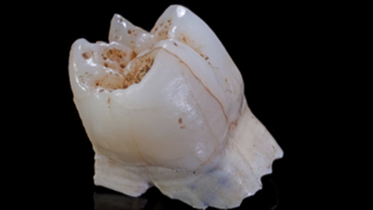 Première molaire supérieure droite d'un Early Homo.