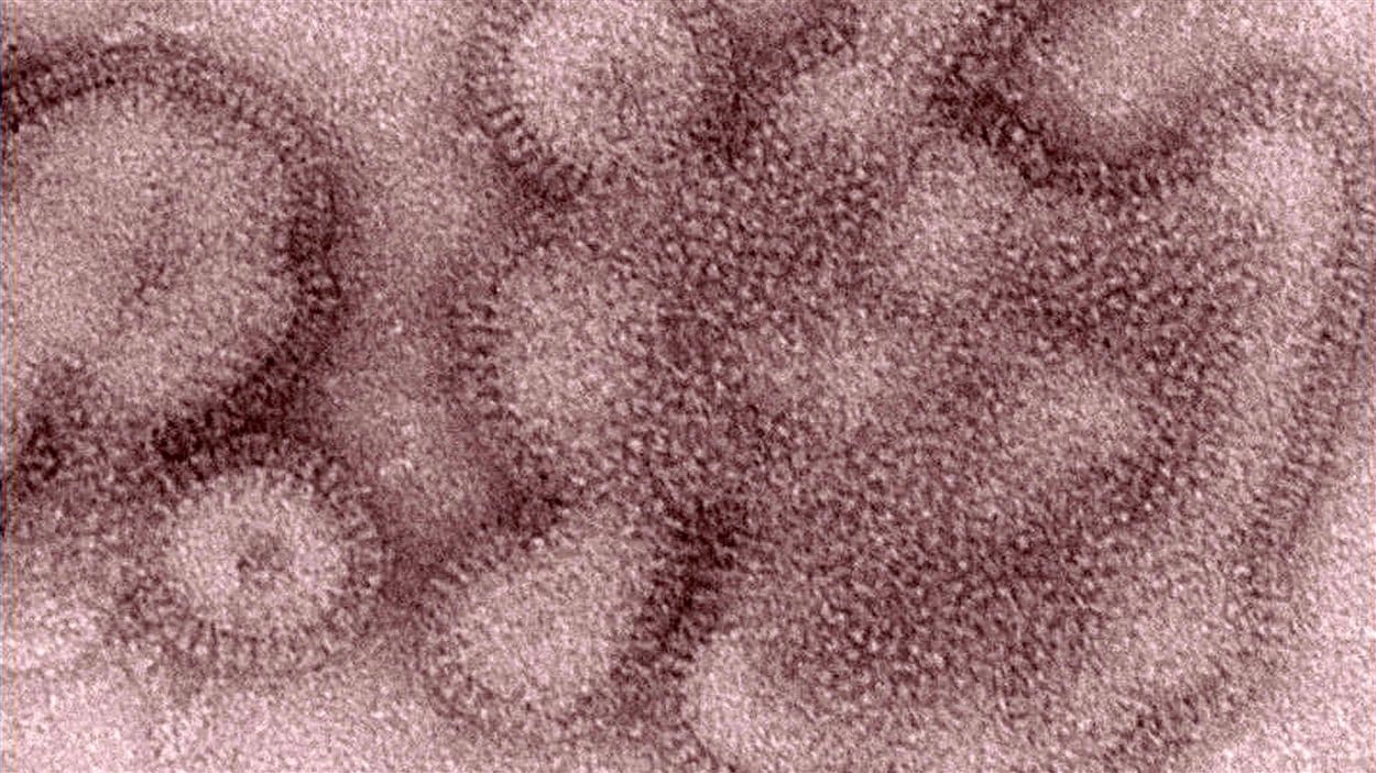 Le virus de la grippe porcine H3N2