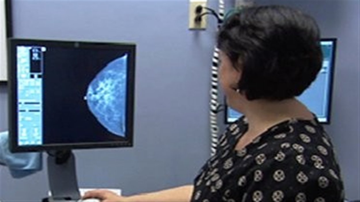 Une mammographie