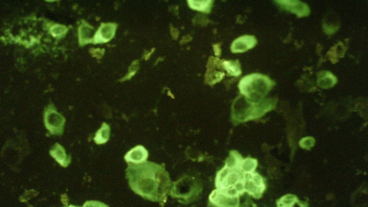 Des cellules humaines infectées par le SRAS