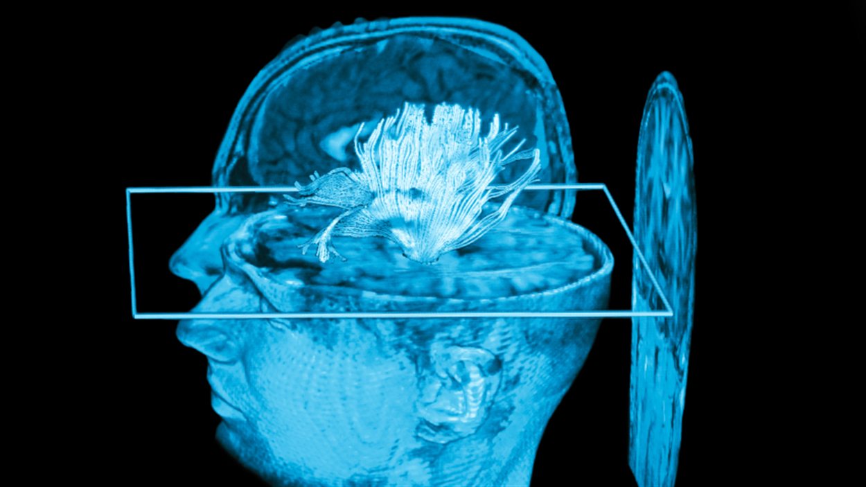 Un examen du cerveau