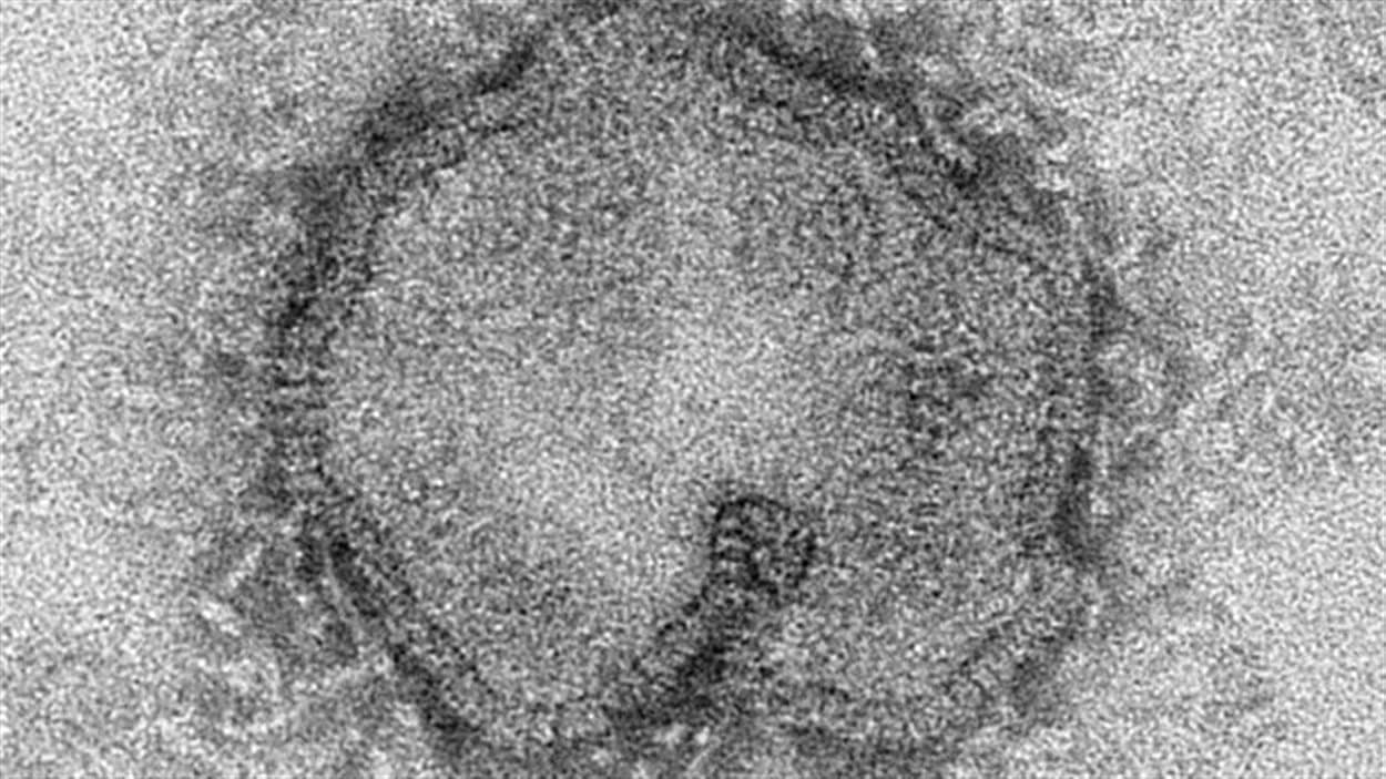 Une image fournit par les Centers for Disease Control and Prevention des États-Unis le 15 avril 2013 montre le virus H7N9 qui peut prendre différentes formes.