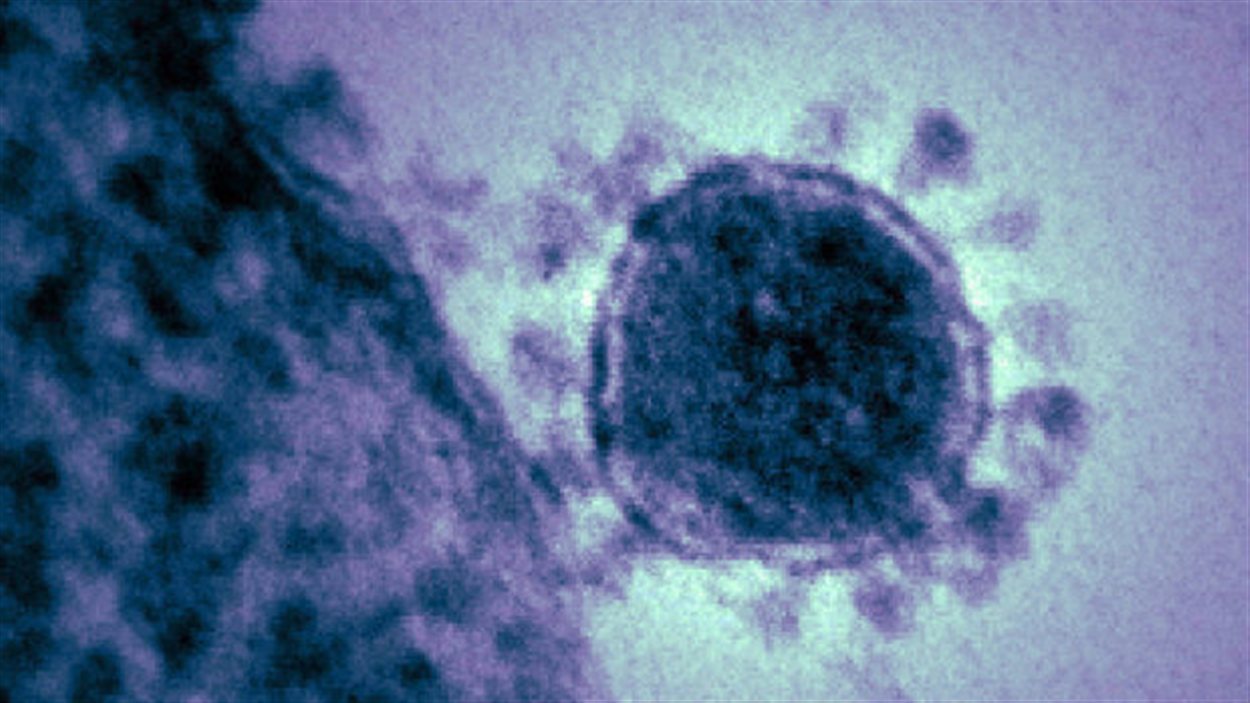 Un coronavirus