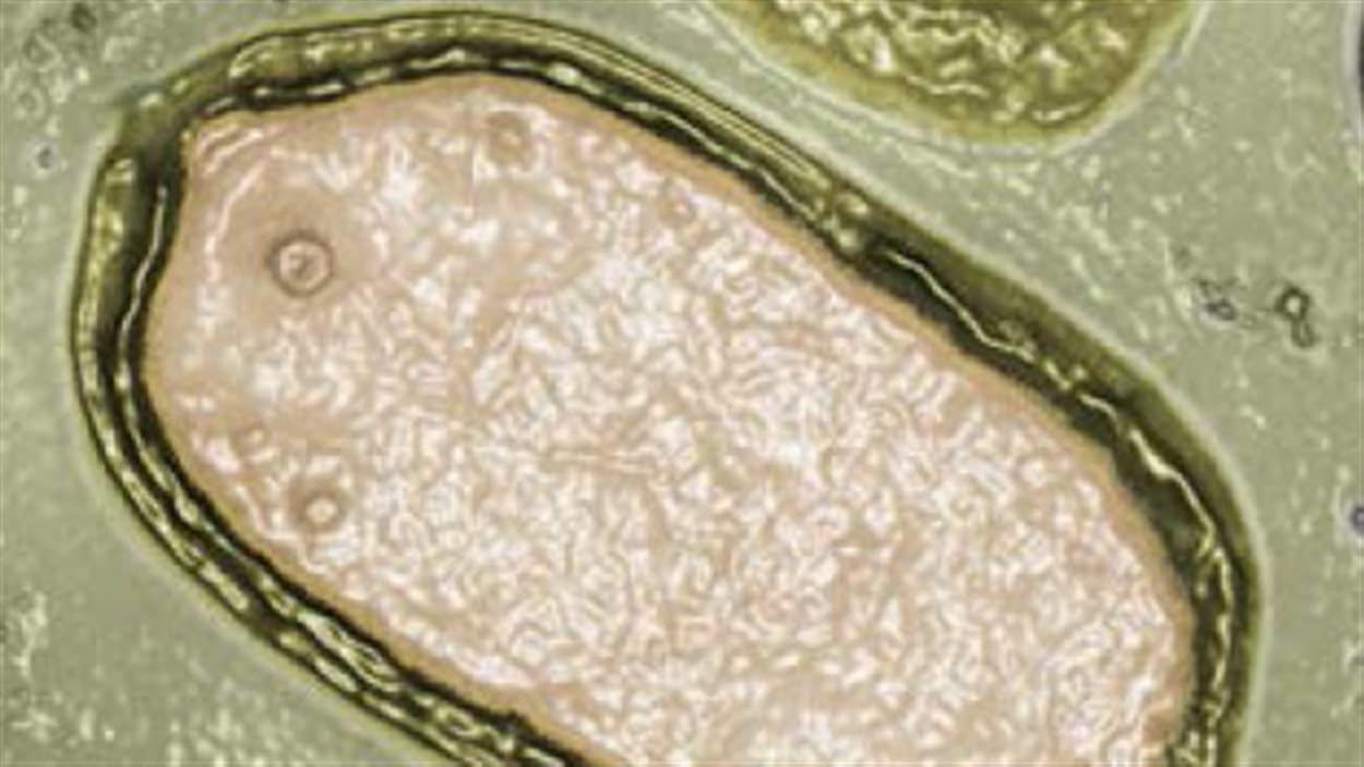 Pandoravirus salinus observé par microscopie électronique