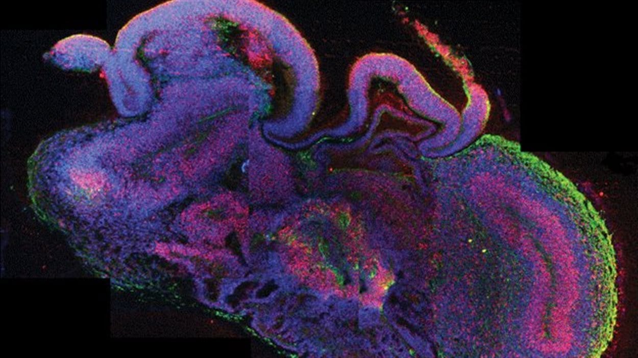 Coupe transversale d'un mini cerveau créé à partir de cellules neurales dérivées de cellules souches humaines.