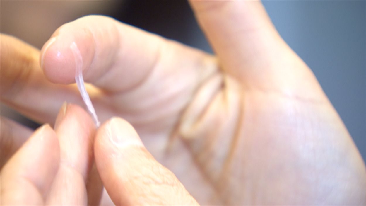 Une languette de peau produite en laboratoire