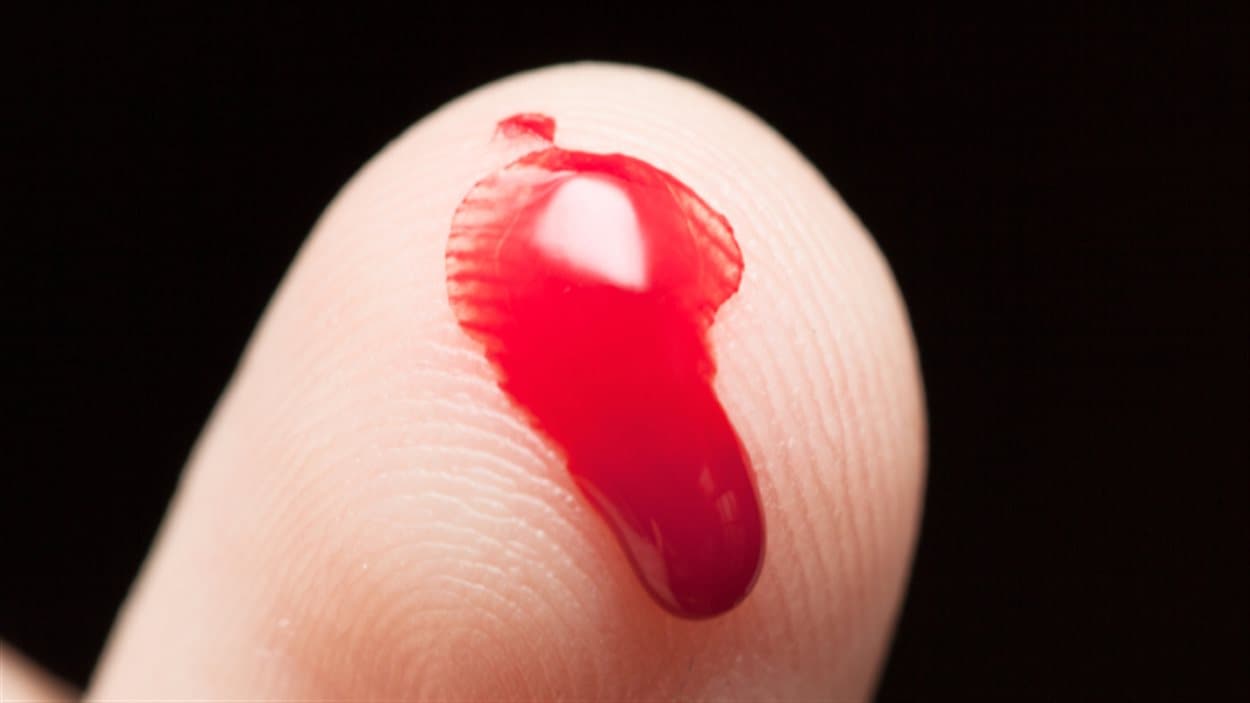 Sangre en el dedo
