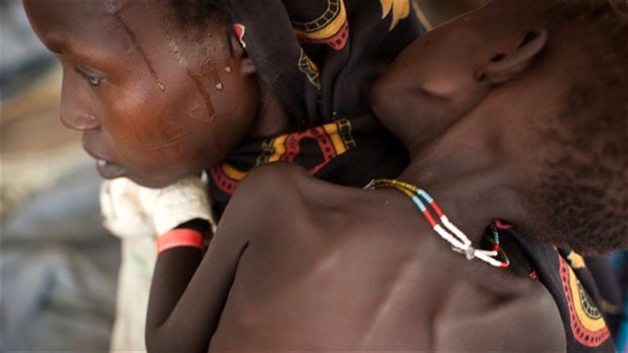 La famine au Soudan du Sud