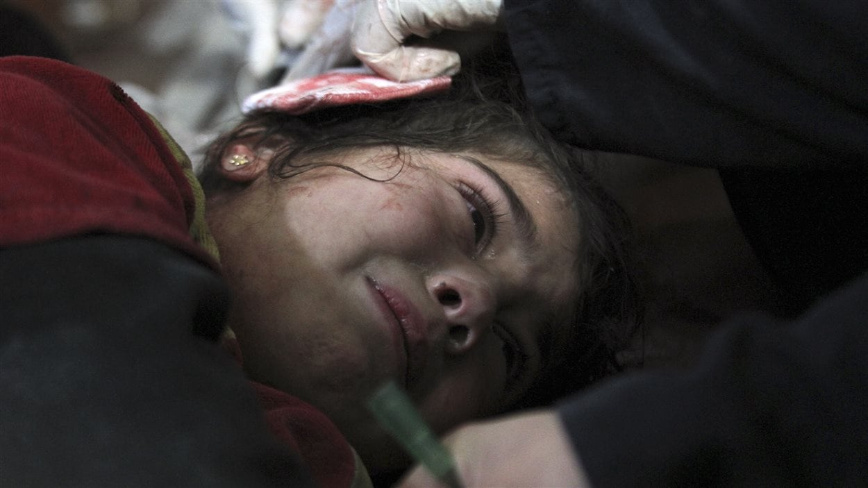 Un enfant, blessé, dans un hôpital de Damas (archives)