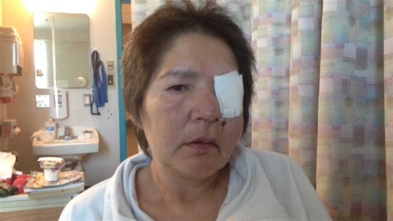 Marlene Bird, avec un couvre-oeil, dans une salle d'hôpital