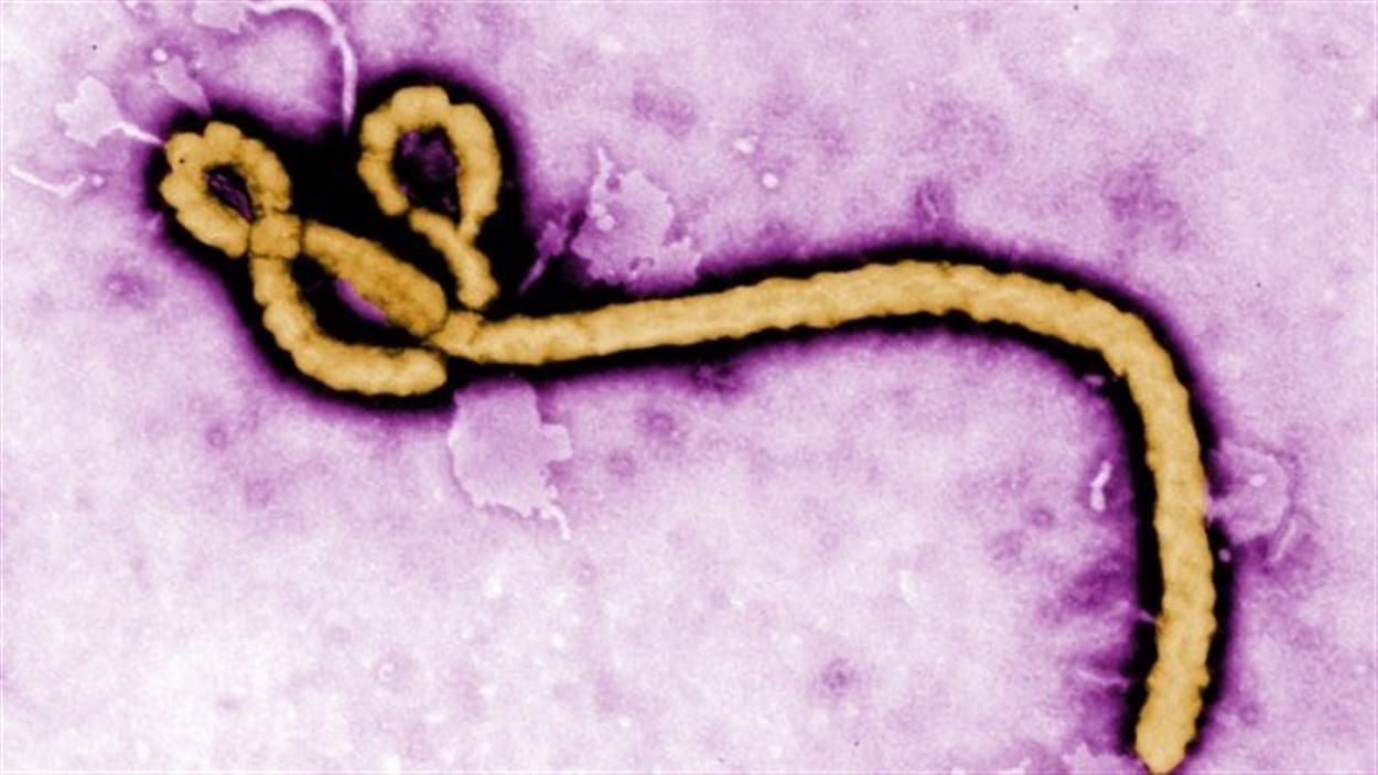 Virus de l'Ebola