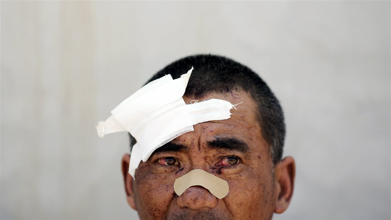 Un homme blessé, évacué de la zone résidentielle près du site de l'explosion, regarde la fumée émaner du quartier de Binhai, à Tianjin.
