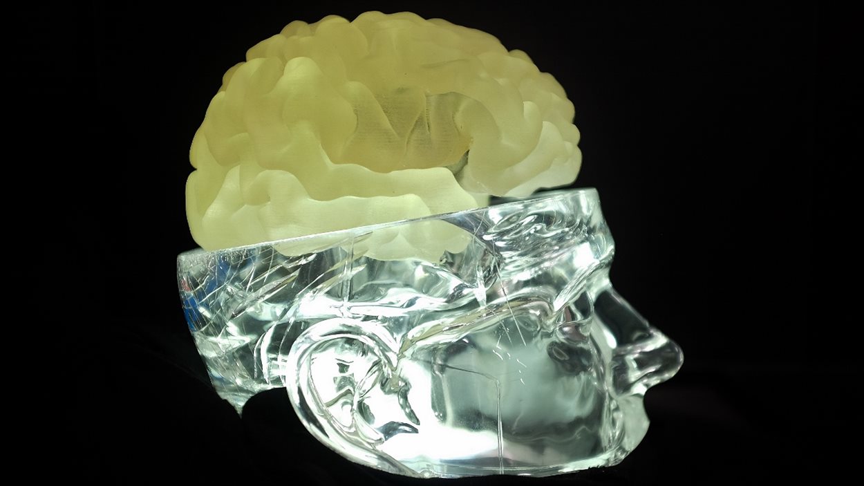 Le modèle 3D d'un cerveau permet aux chirurgiens de se pratiquer avant une chirurgie complexe.