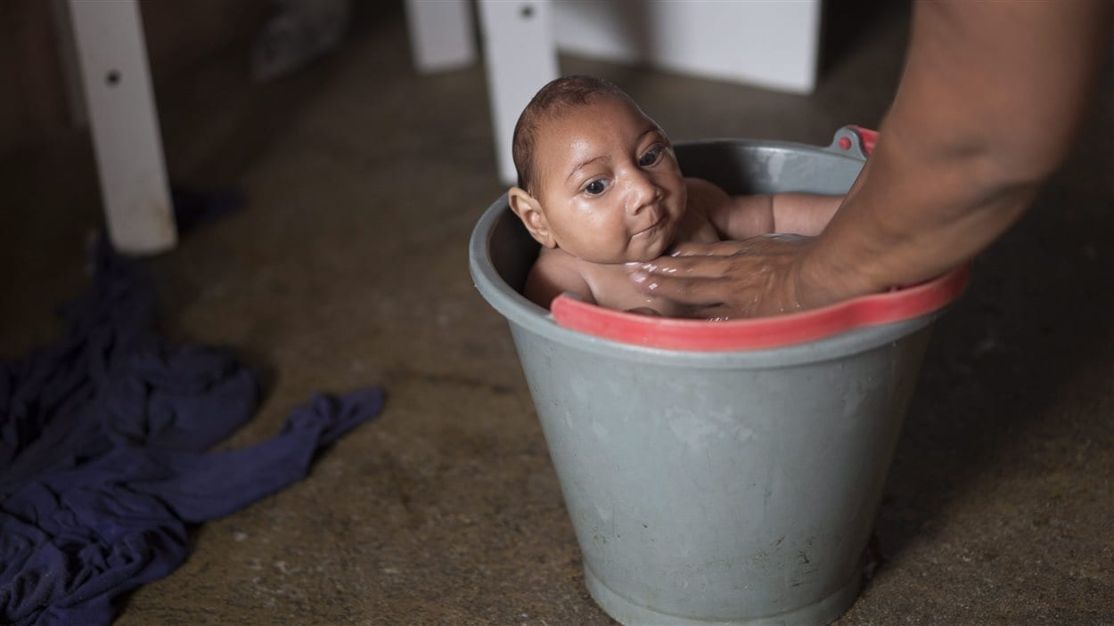 La brésilienne Solange Ferreira, une femme infectée par le virus Zika, a donné naissance à Jose, atteint de microcéphalie.