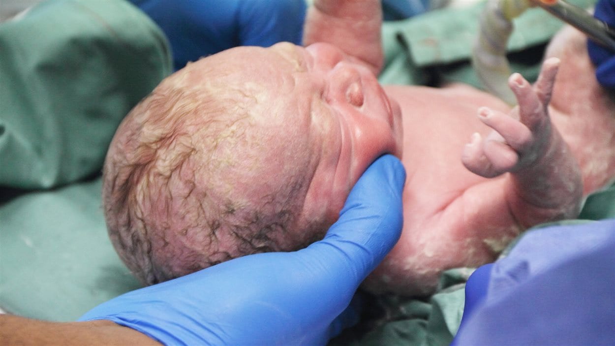 Un médecin tient un nourrisson né de façon prématurée. 