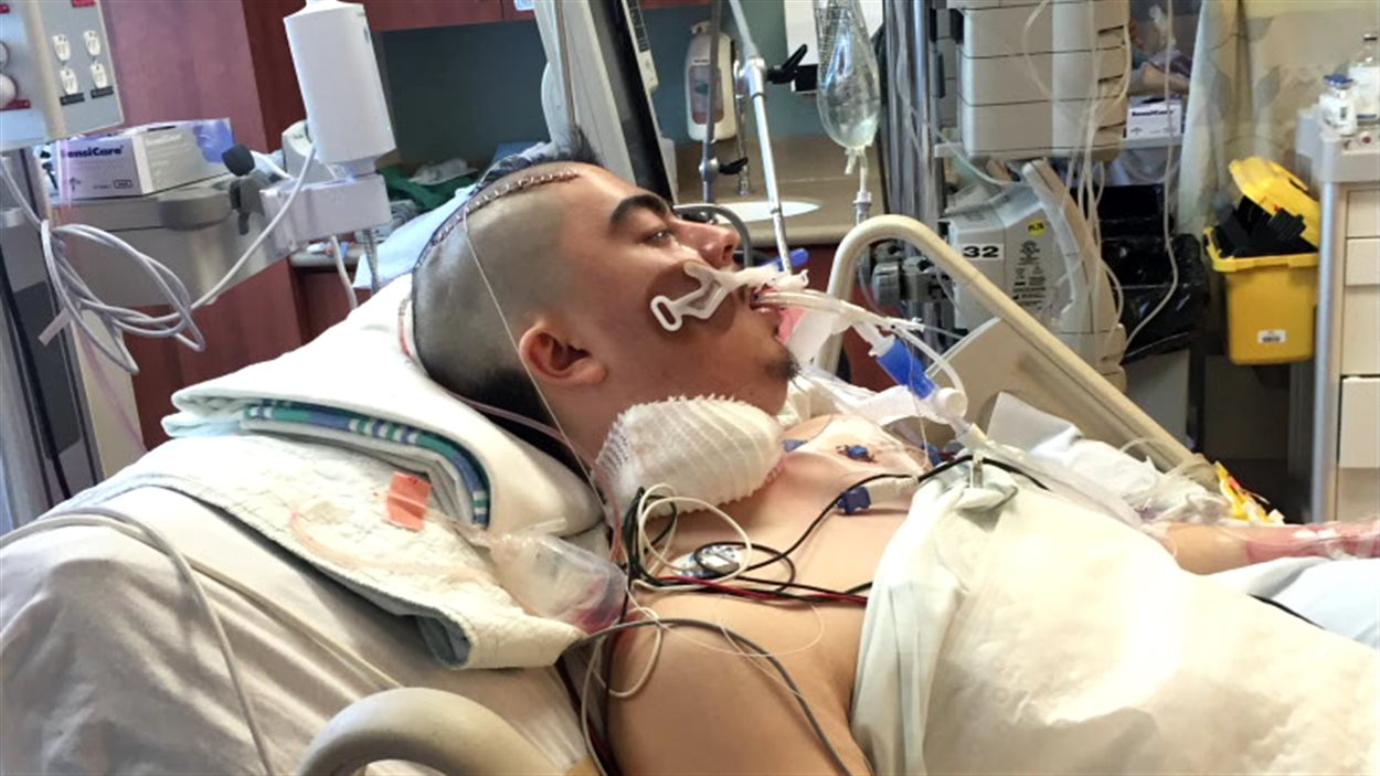 Un jeune homme plongé dans un coma artificiel après une visite chez le dentiste RadioCanada Un jeune homme plongé dans un coma artificiel après une visite chez le dentiste RadioCanada