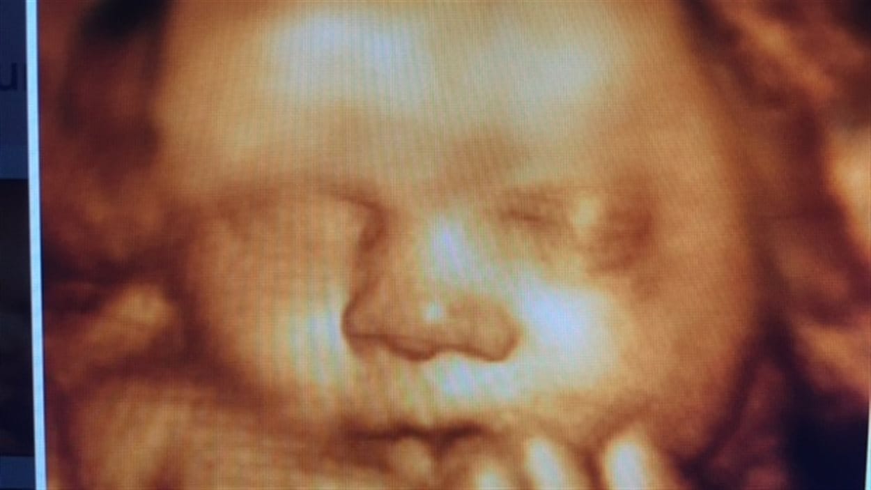 Une échographie du site UC Baby (vidéo promotionnelle).