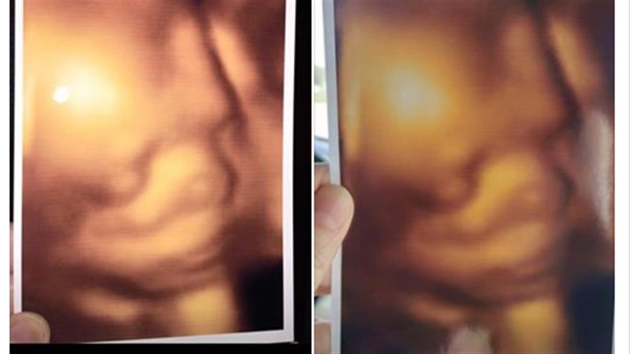 Echographie 3d Les Memes Photos Vendues A Differents Parents De La Region De Toronto Radio Canada Ca